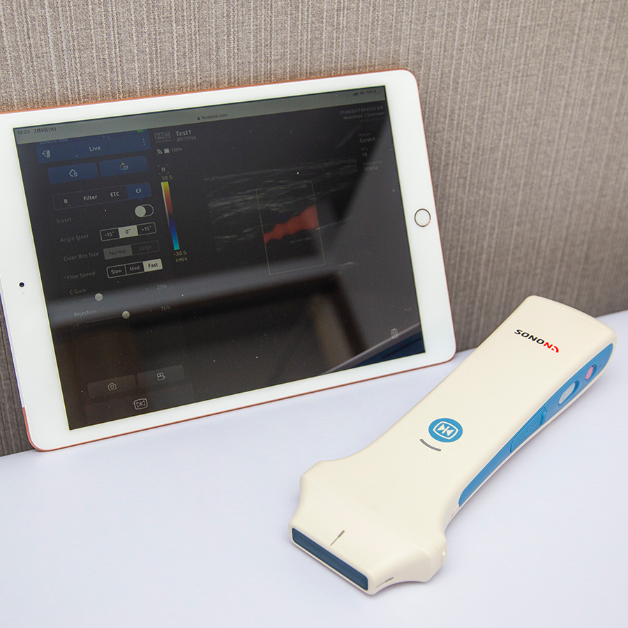 ハイボルテージ